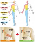 帶狀皰疹癥狀表現(xiàn)是什么樣的？